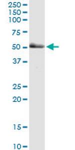 PAK2 Monoclonal Antibody (1E1)