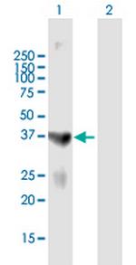 PARK2 Polyclonal Antibody, MaxPab™