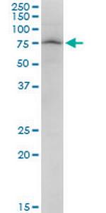 PARN Polyclonal Antibody, MaxPab™