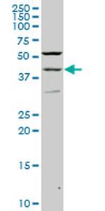 PAX2 Monoclonal Antibody (2E4)
