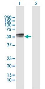 PAX3 Polyclonal Antibody, MaxPab™