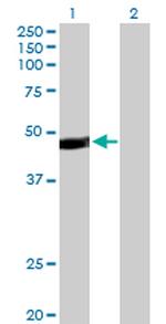 PAX5 Antibody in Western Blot (WB)
