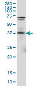PAX5 Antibody in Western Blot (WB)