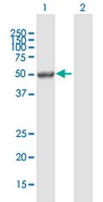PAX6 Antibody in Western Blot (WB)