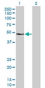 PAX6 Polyclonal Antibody, MaxPab™