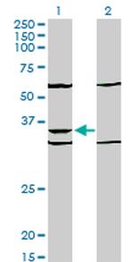 PAX9 Antibody in Western Blot (WB)