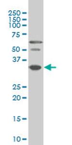 PAX9 Antibody in Western Blot (WB)