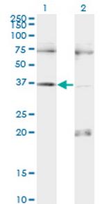 PAX9 Monoclonal Antibody (3B8)