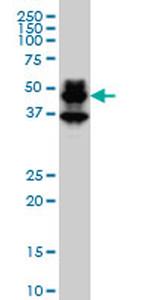 PBX1 Antibody in Western Blot (WB)