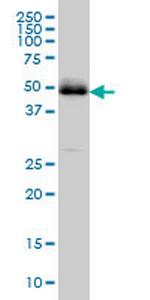 PBX2 Monoclonal Antibody (2E9)