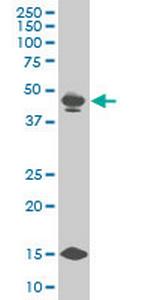 PBX3 Monoclonal Antibody (2E12)