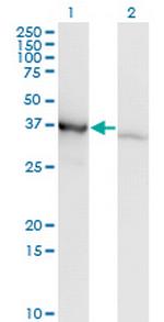 PCBP1 Monoclonal Antibody (1G2)