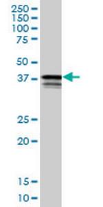 PCBP2 Monoclonal Antibody (1B6)