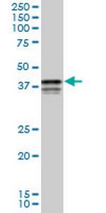 PCBP2 Monoclonal Antibody (3A1)