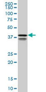 PCBP2 Monoclonal Antibody (1C7)