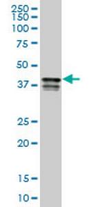 PCBP2 Monoclonal Antibody (6B6)
