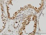 PCBP2 Antibody in Immunohistochemistry (Paraffin) (IHC (P))