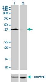 PCBP2 Antibody in Western Blot (WB)