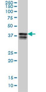 PCBP2 Antibody in Western Blot (WB)
