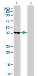 PCBP2 Antibody in Western Blot (WB)