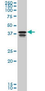 PCBP2 Monoclonal Antibody (6E9)