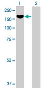 PCDH8 Antibody in Western Blot (WB)