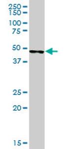 SERPINA5 Antibody in Western Blot (WB)