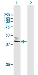 SERPINA5 Polyclonal Antibody, MaxPab™