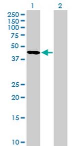 SERPINA5 Antibody in Western Blot (WB)