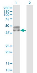 SERPINA5 Antibody in Western Blot (WB)