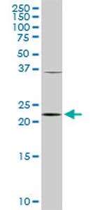 PCMT1 Antibody in Western Blot (WB)
