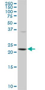 PCMT1 Monoclonal Antibody (1D6)