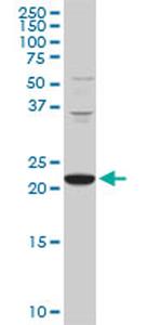 PCMT1 Antibody in Western Blot (WB)