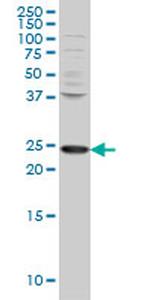 PCMT1 Antibody in Western Blot (WB)