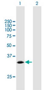PCNA Antibody in Western Blot (WB)