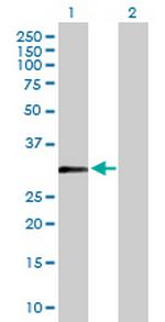 PCNA Antibody in Western Blot (WB)