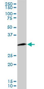 PCNA Antibody in Western Blot (WB)
