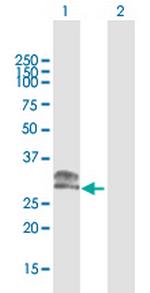 CHMP1A Polyclonal Antibody, MaxPab™