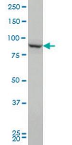 PCSK1 Antibody in Western Blot (WB)