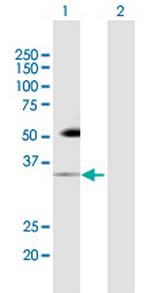 PDCD1 Antibody in Western Blot (WB)