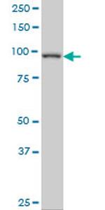 PDE4C Antibody in Western Blot (WB)