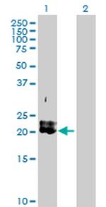PDGFA Polyclonal Antibody, MaxPab™
