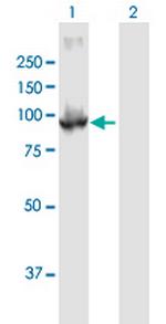 PDE6B Polyclonal Antibody, MaxPab™