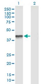 PDHA2 Antibody in Western Blot (WB)