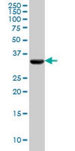 PDHB Monoclonal Antibody (2B2)