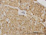 PDK2 Monoclonal Antibody (5F8)