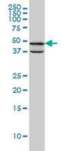 PDK3 Monoclonal Antibody (2B11)