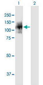 ENPP1 Polyclonal Antibody, MaxPab™