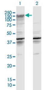 ENPP2 Polyclonal Antibody, MaxPab™