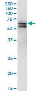 PDPK1 Monoclonal Antibody (2E2)